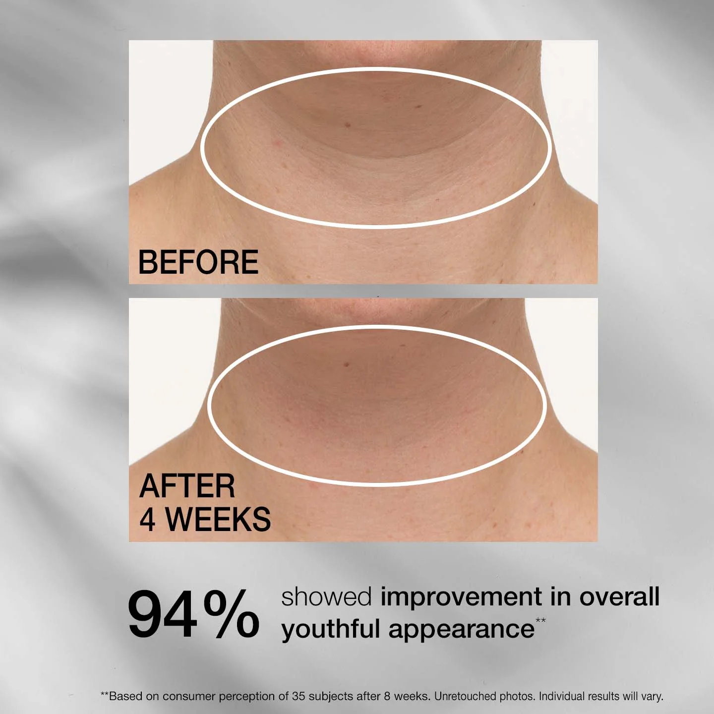 Tighten & Lift TL Advanced Tightening Neck Cream Plus 30 ml