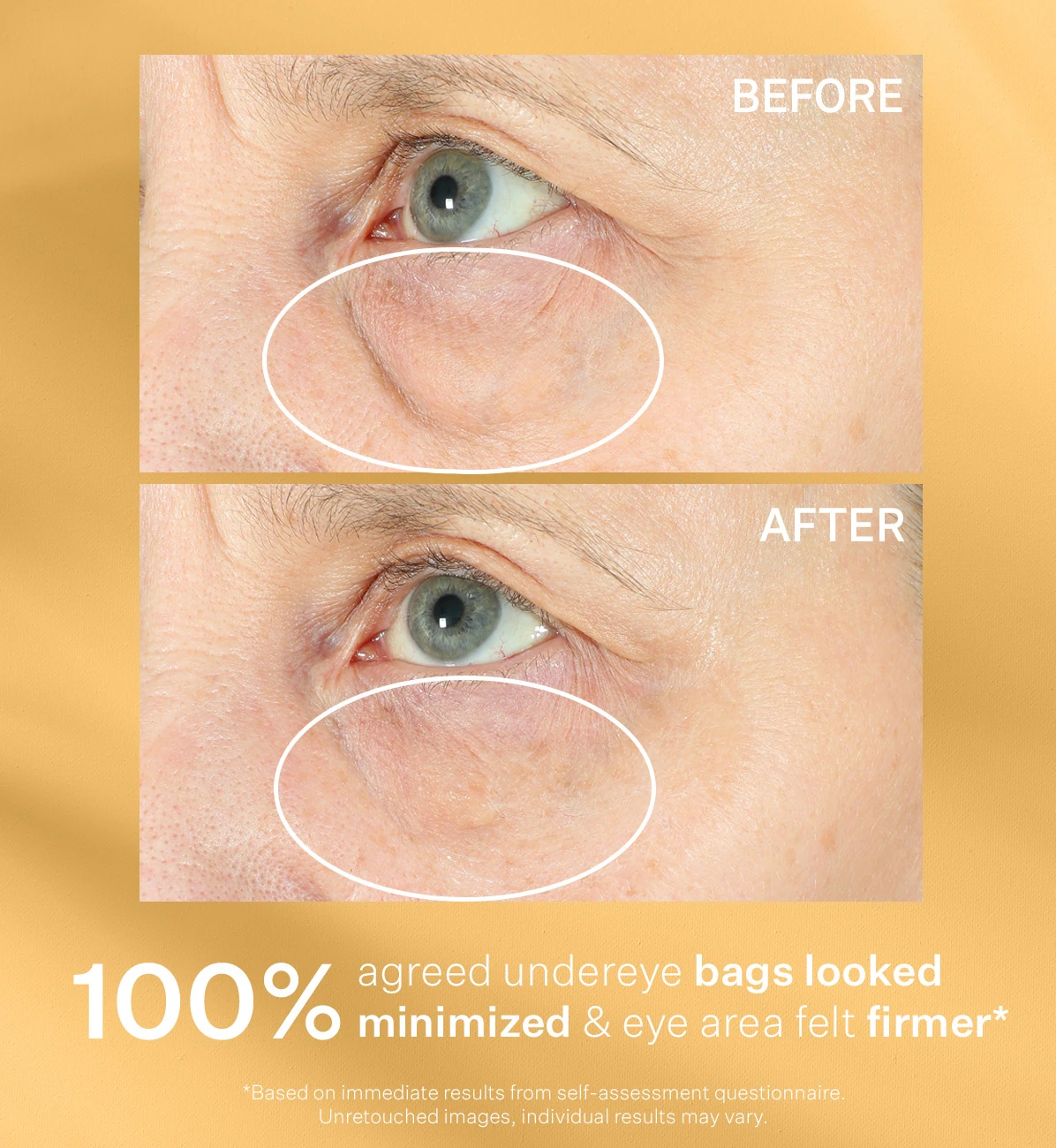 Tighten & Lift Hyperlift Eye Instant Eye Fix 10 ml