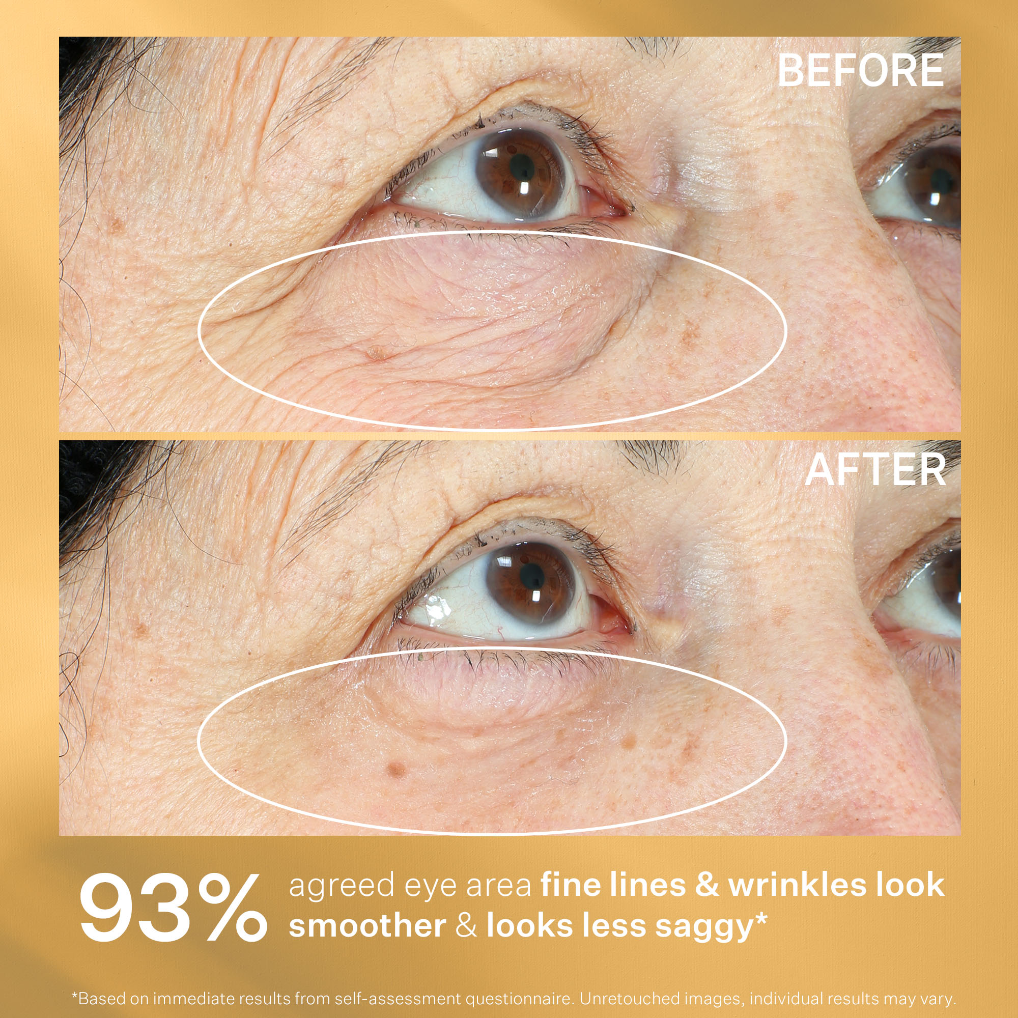 Tighten & Lift Hyperlift Eye Instant Eye Fix 10 ml