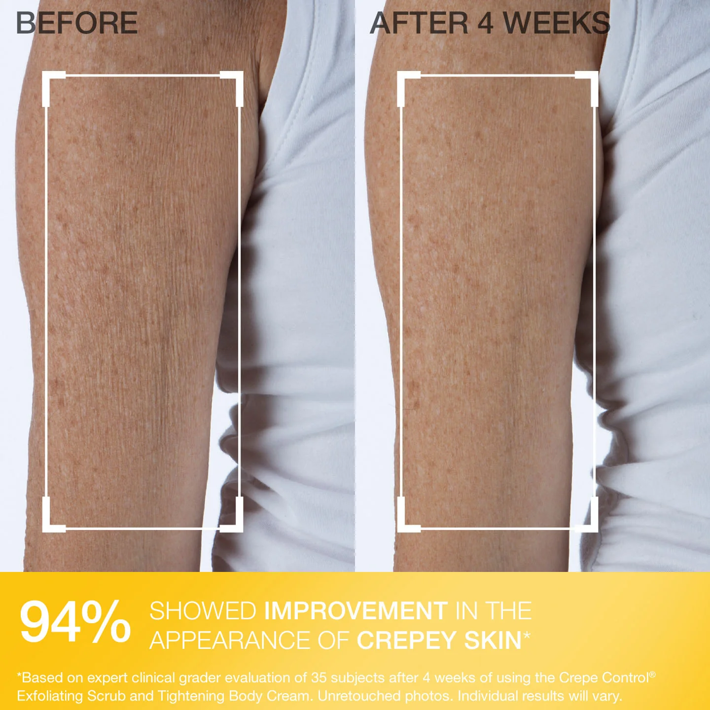 Crepe Control Tightening Body Cream 200 ml