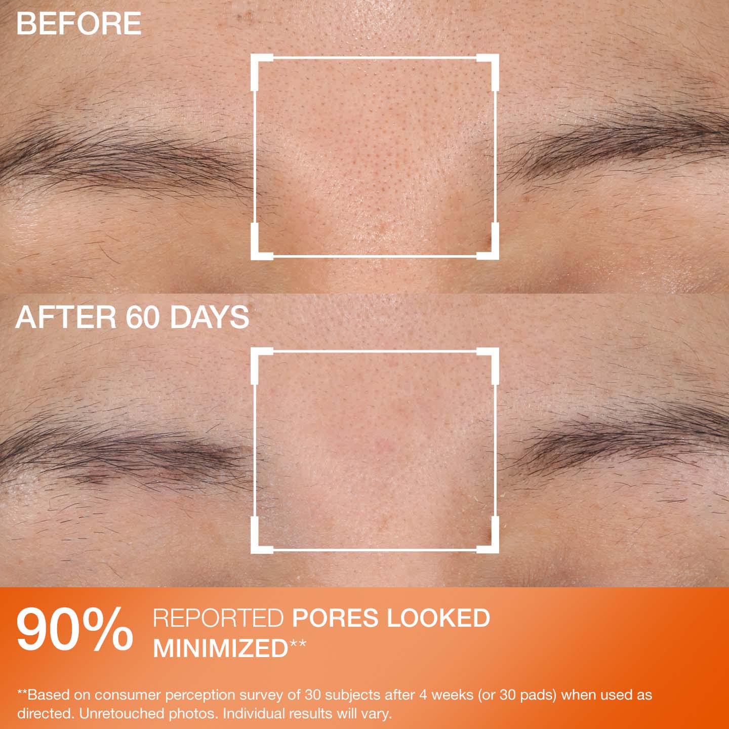 Advanced Resurfacing Daily Reveal Exfoliating Pads 60 Adet