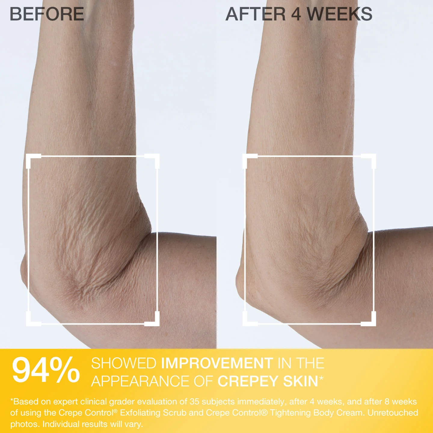 Crepe Control Exfoliating Body Scrub 150 ml