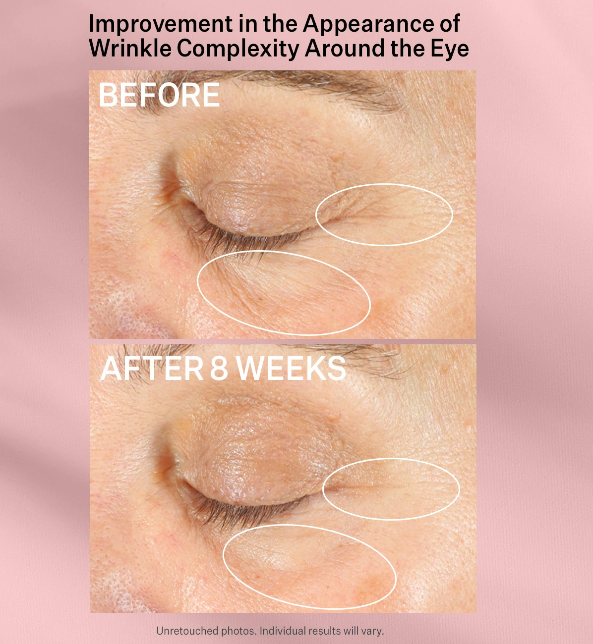 Advanced Retinol Multi Correct Eye Cream 15 ml