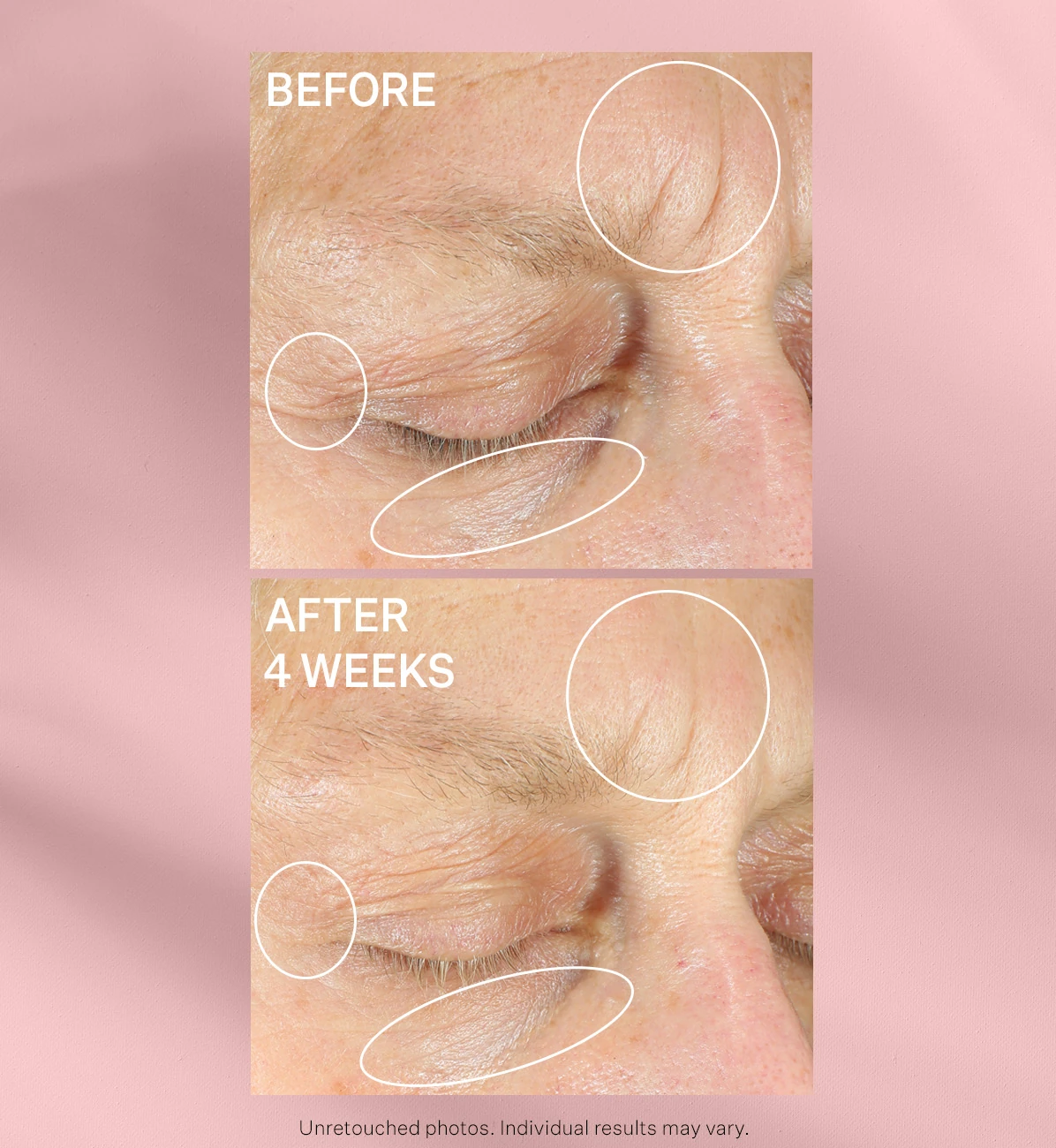 Anti Wrinkle Intensive Eye Concentrate for Wrinkles 30 ml