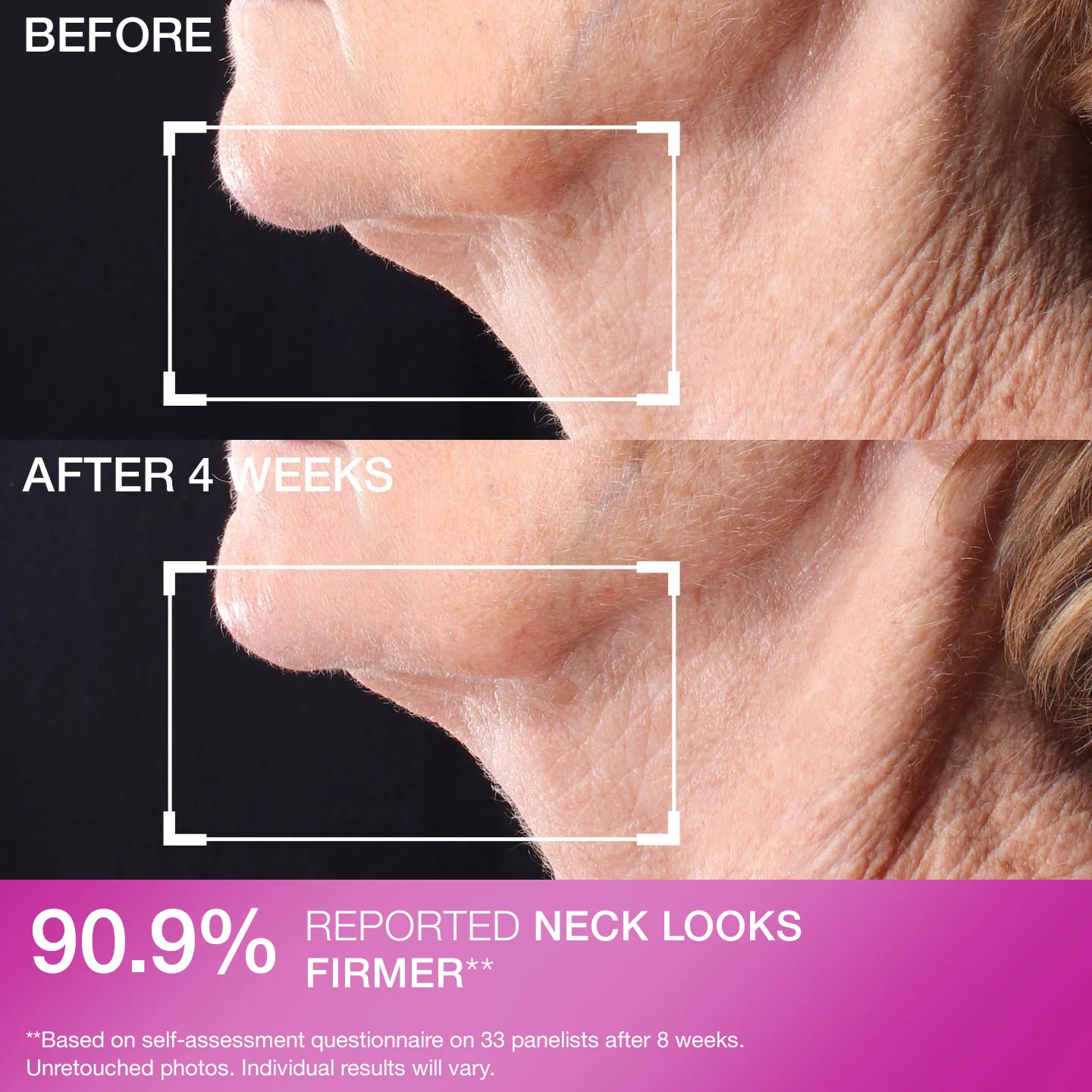 Tightening Neck Boyun Sıkılaştırıcı Roller Serum 50 ml