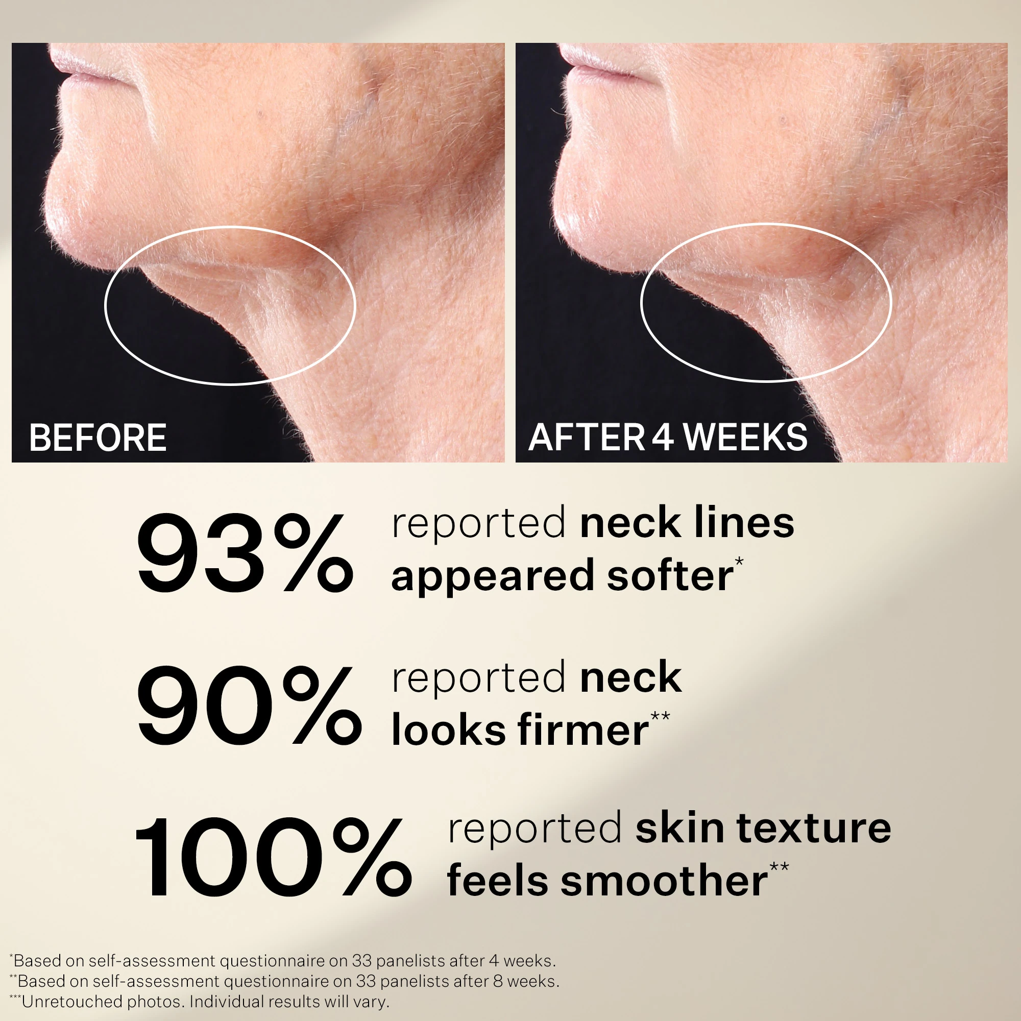 Tightening Neck Boyun Sıkılaştırıcı Roller Serum 50 ml