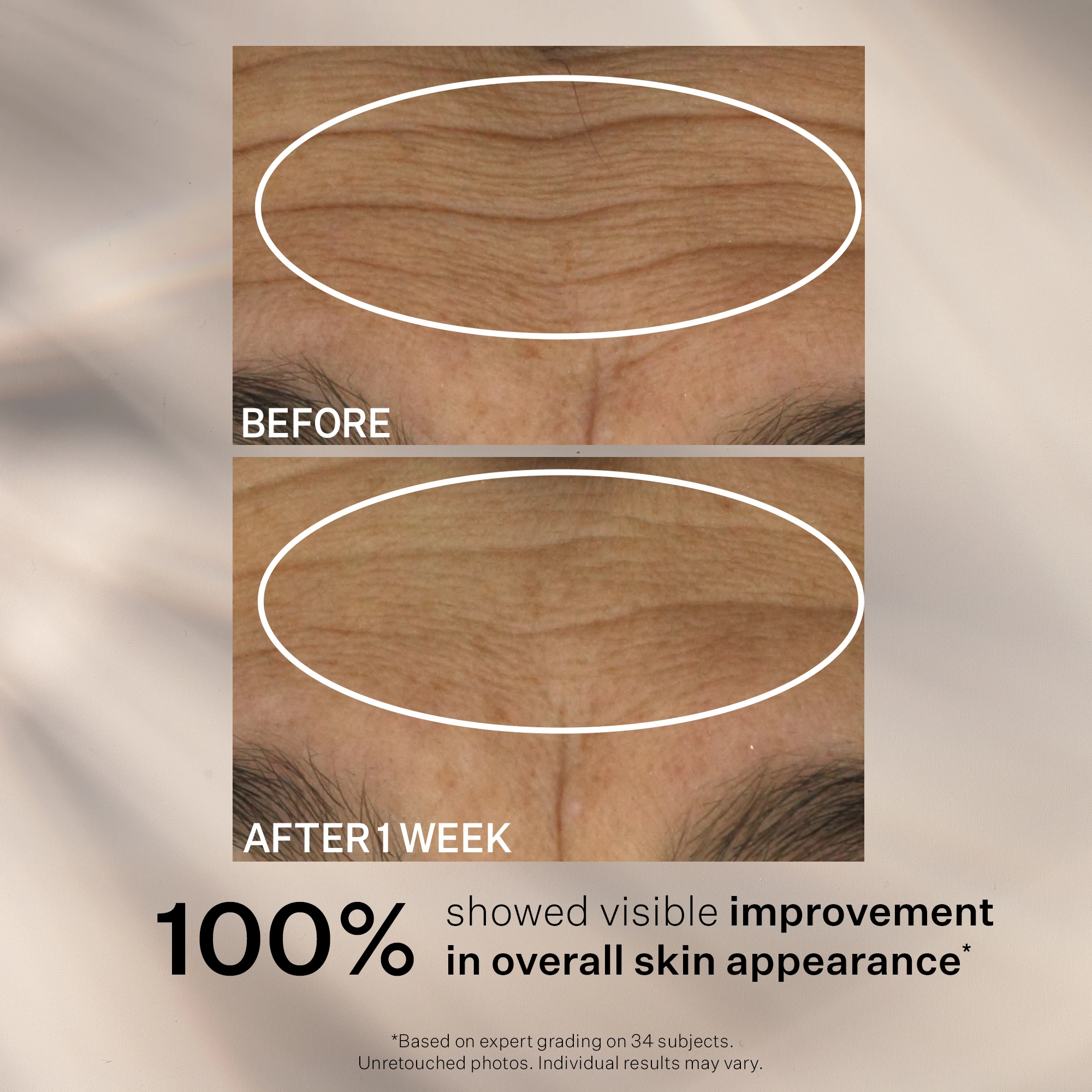 Anti Wrinkle Wrinkle Recode Moisture Rich Barrier Cream 50 ml