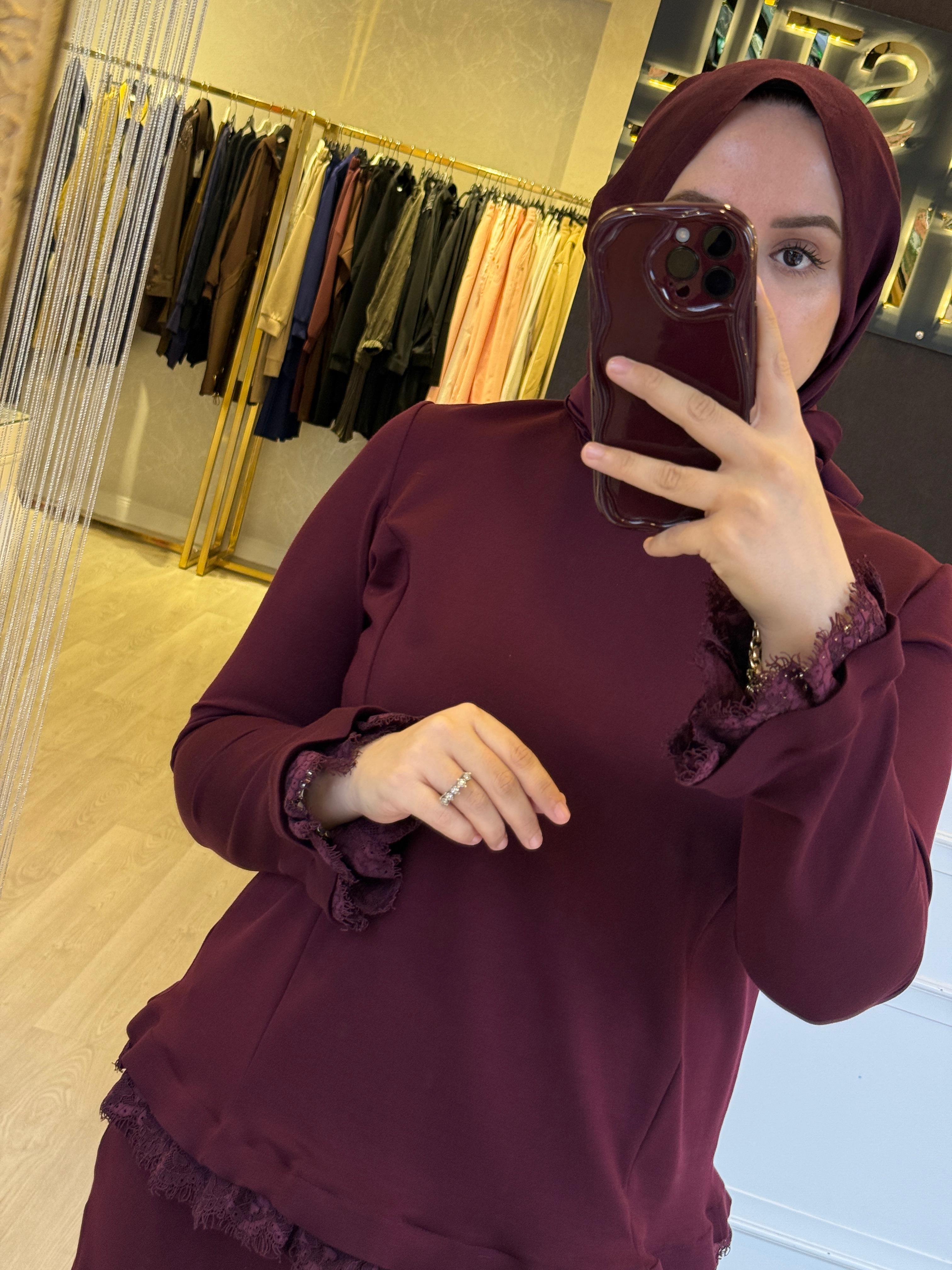 MİSSWHENCE 38004 Bilek Etek Ucu ve Tunik Ucu Dantel Güpür Detaylı Etekli Takım