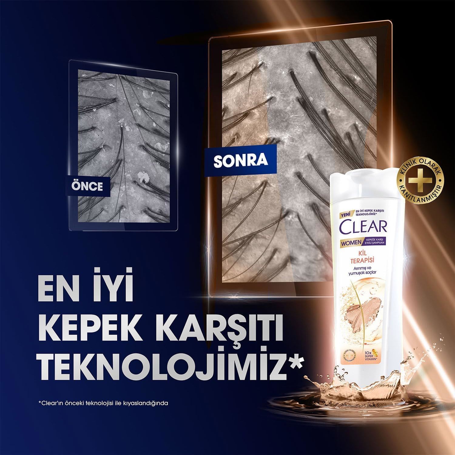 Clear Kil Terapisi 350 ml Şampuan