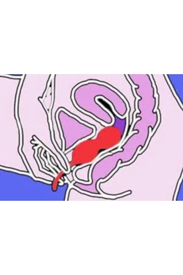 Kegel Vajina İçi Egzersiz ve Doğum Sonrası Vajina Daraltma Topları