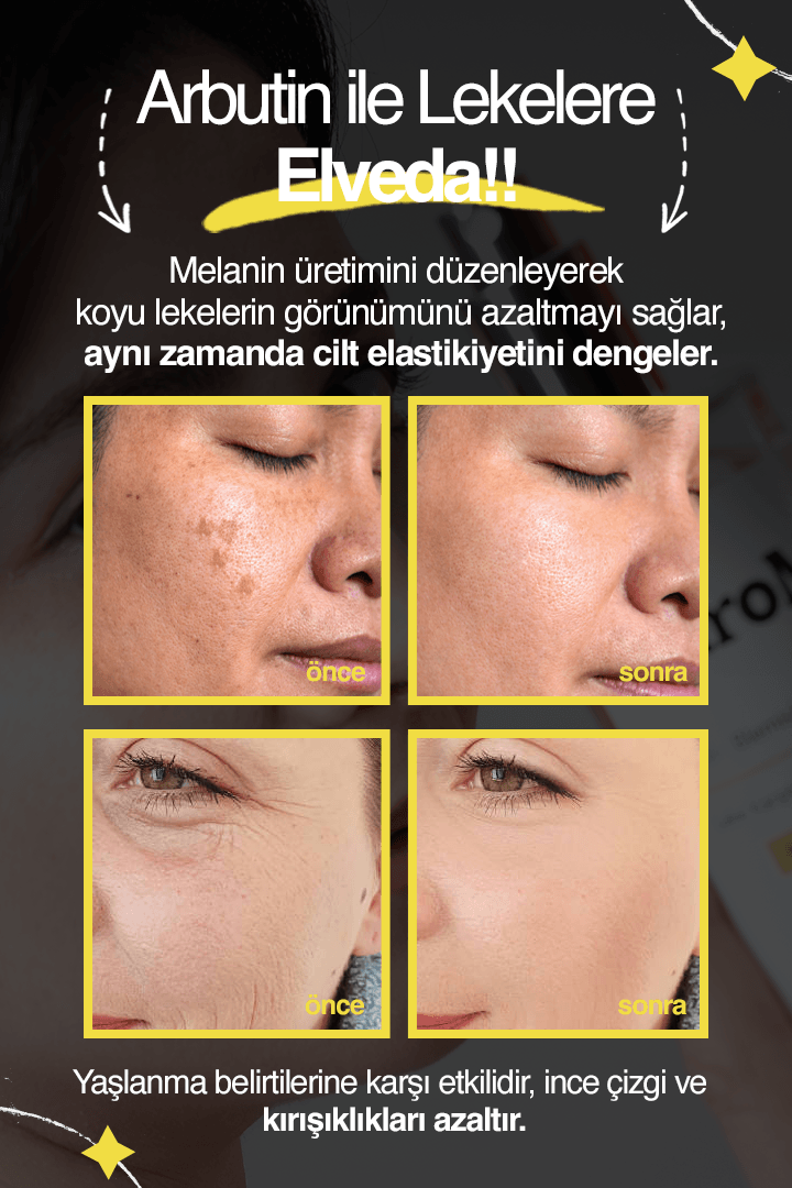 Leke & Yaşlanma Karşıtı Tonik