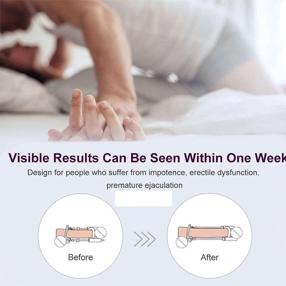bAŞKa Pro Extender Penis Traction Device Medikal Traksiyon Cihazı