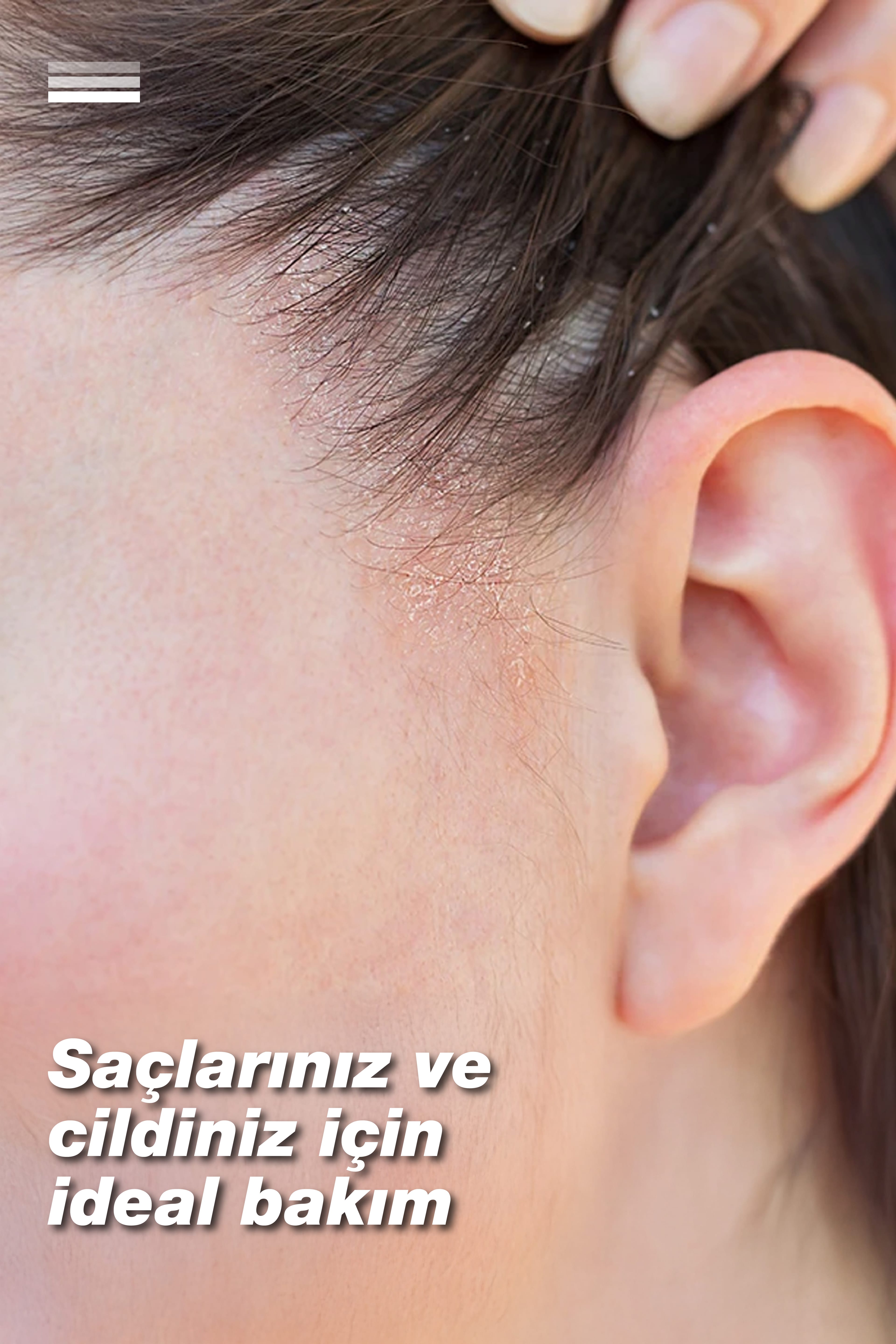 Atofeel Shampoo-Hassas Saç Derisi İçin Hipoalerjenik Şampuan