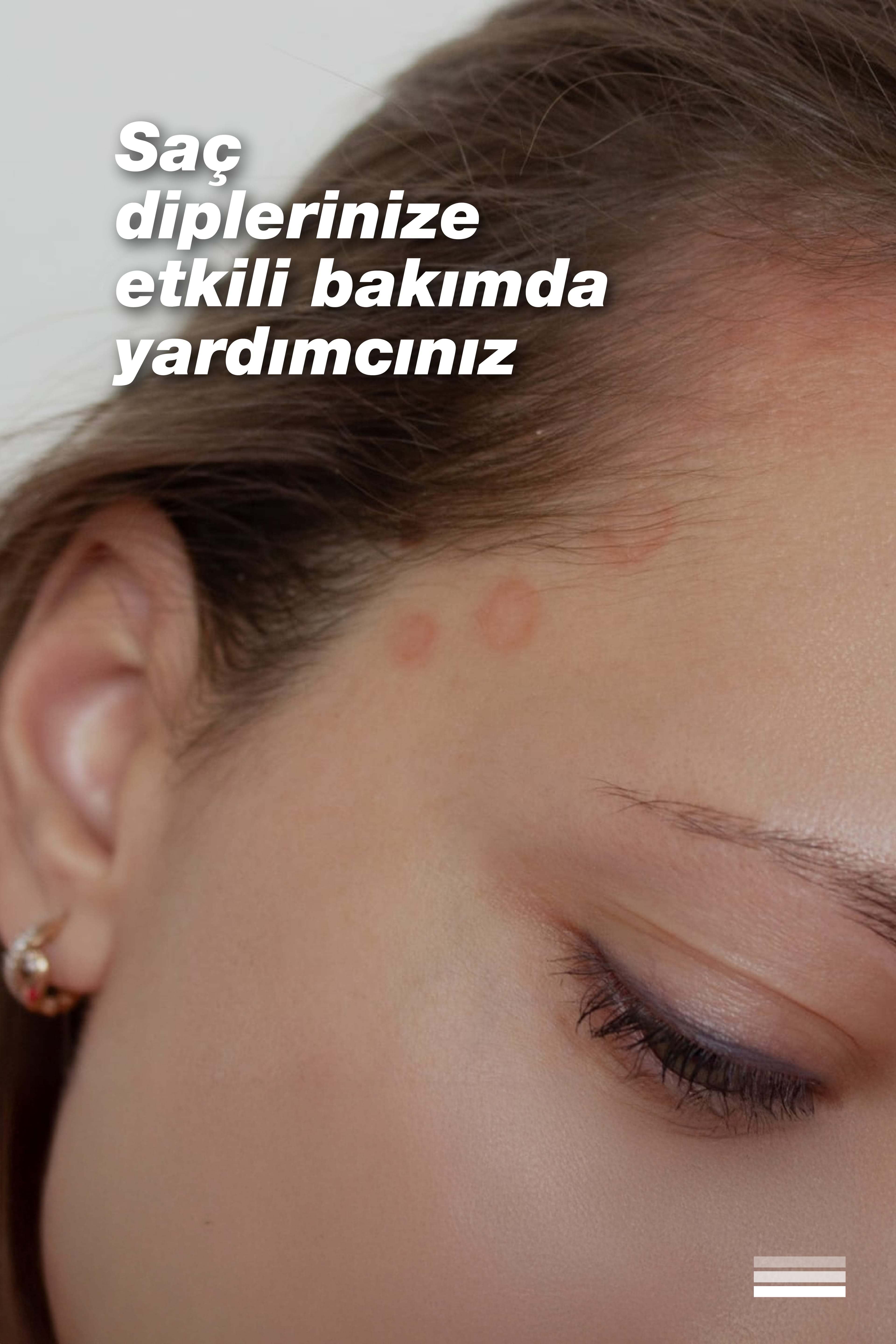 Atofeel Shampoo-Hassas Saç Derisi İçin Hipoalerjenik Şampuan