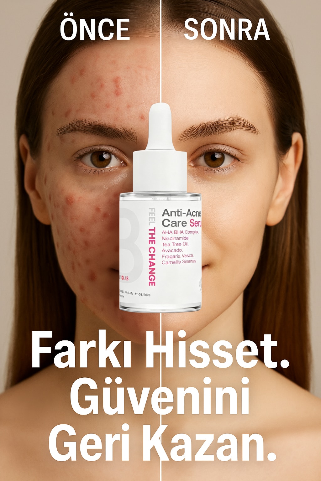Anti-Acne Serum-Peeling Etkili Akne Karşıtı Serumu