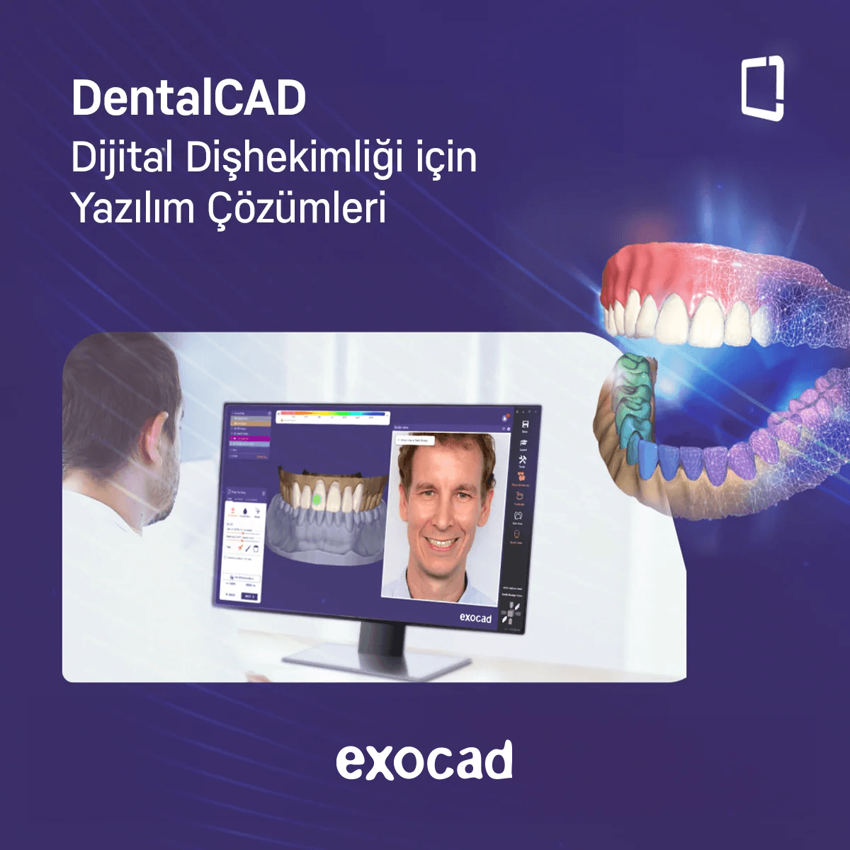 EXOCAD Bundle