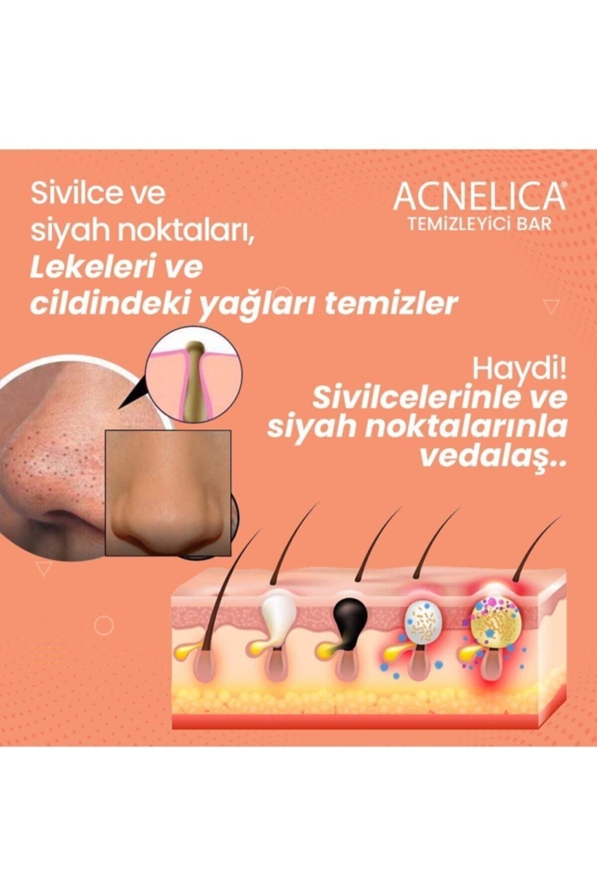 Temizleyici Bar %2 Siyah Nokta Ve Sivilce Sabunu