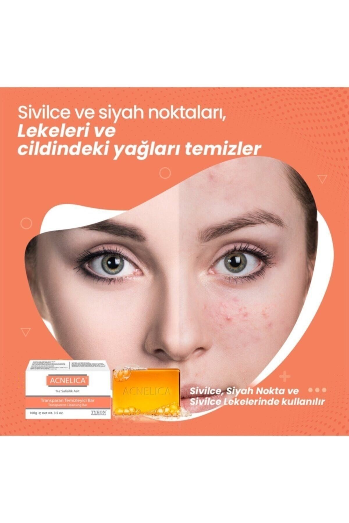 Temizleyici Bar %2 Siyah Nokta Ve Sivilce Sabunu