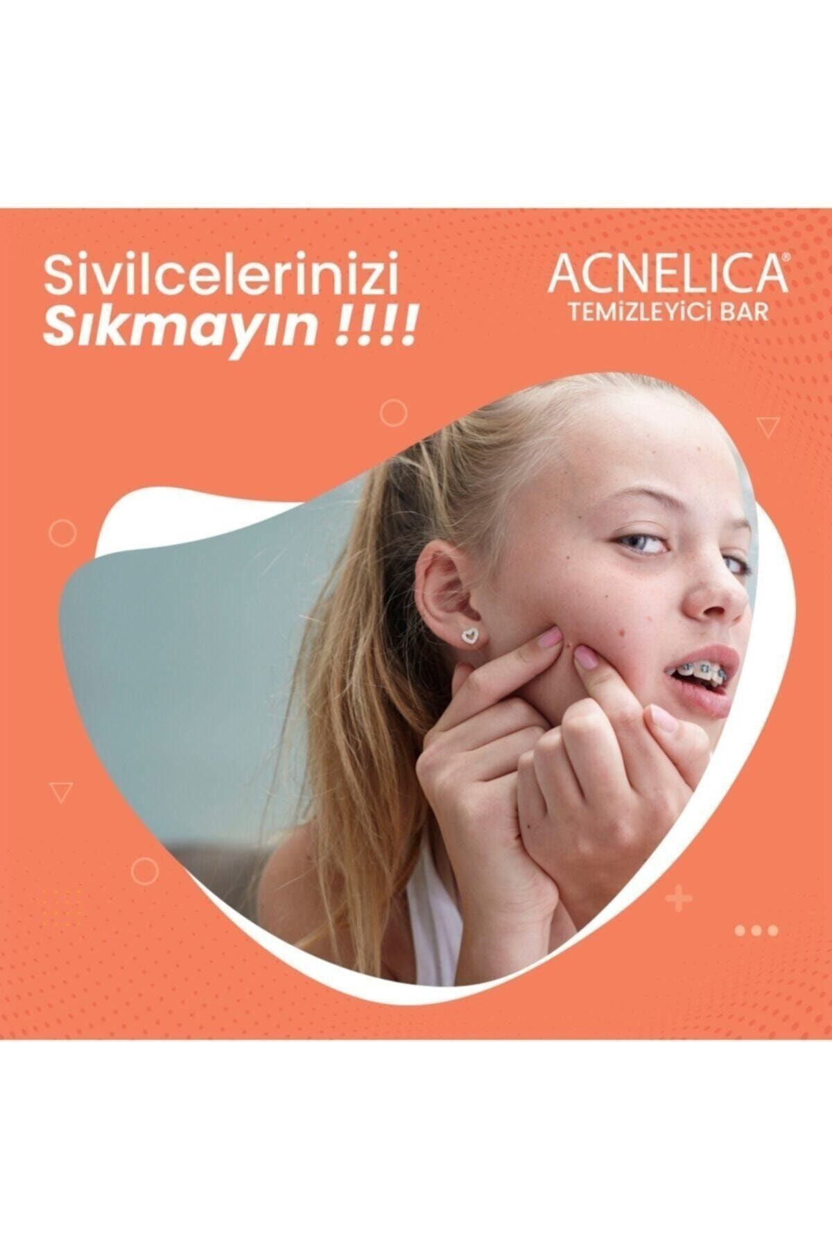 Temizleyici Bar %2 Siyah Nokta Ve Sivilce Sabunu