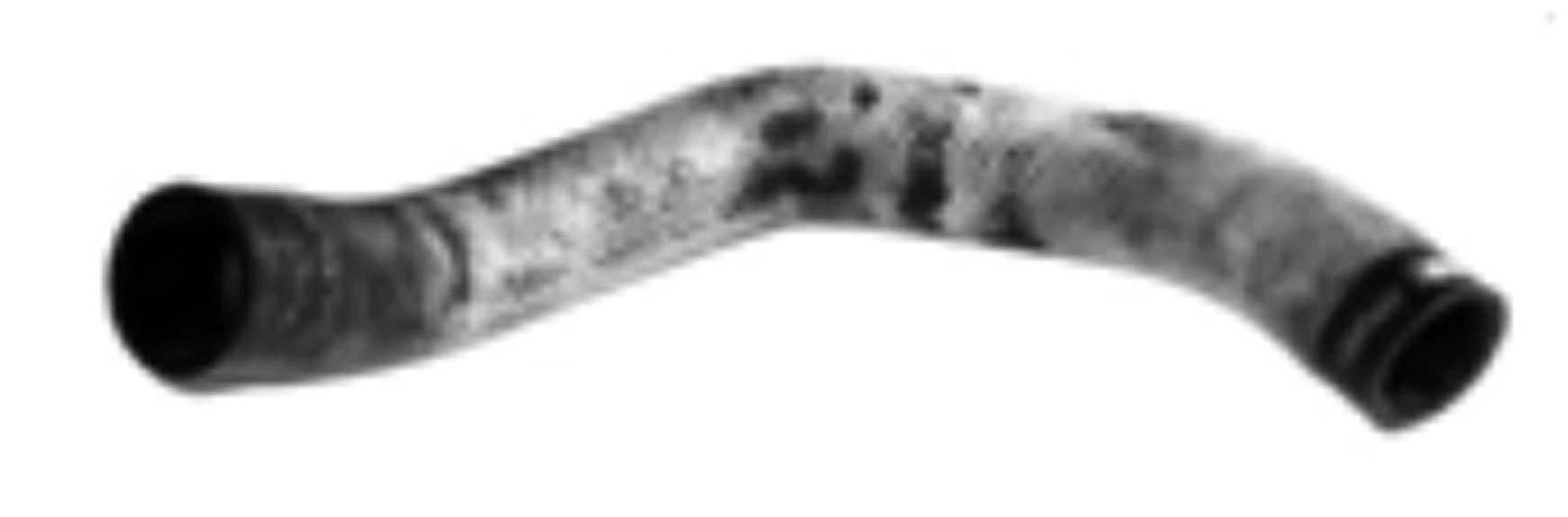 Hyundaı Ticarı Radyator Hortumu Ust H100 Kamyonet 2006> - Gb 74157