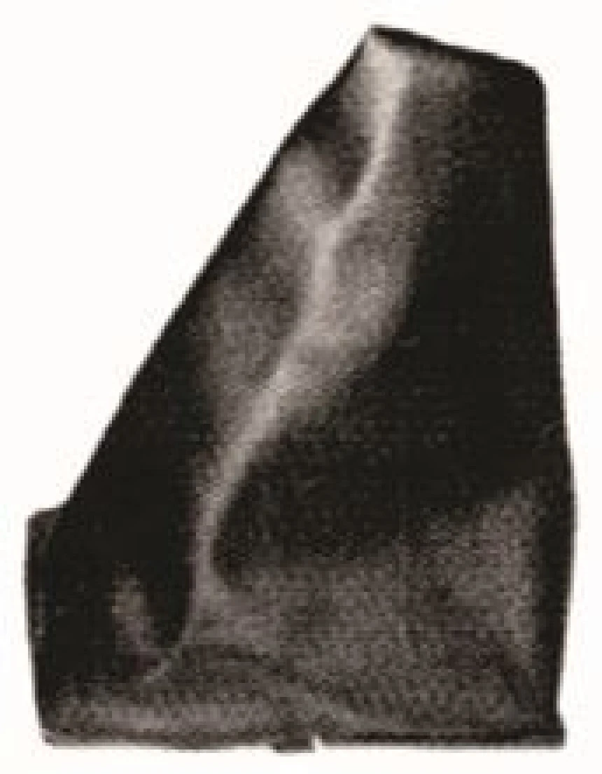 Tofas Vites Korugu Tempra - Mtj 1422