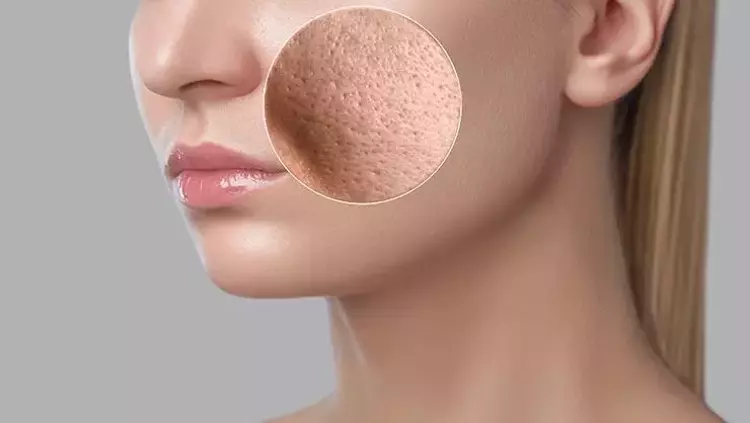 Cilt Tipi Tespiti Nasıl Yapılır?