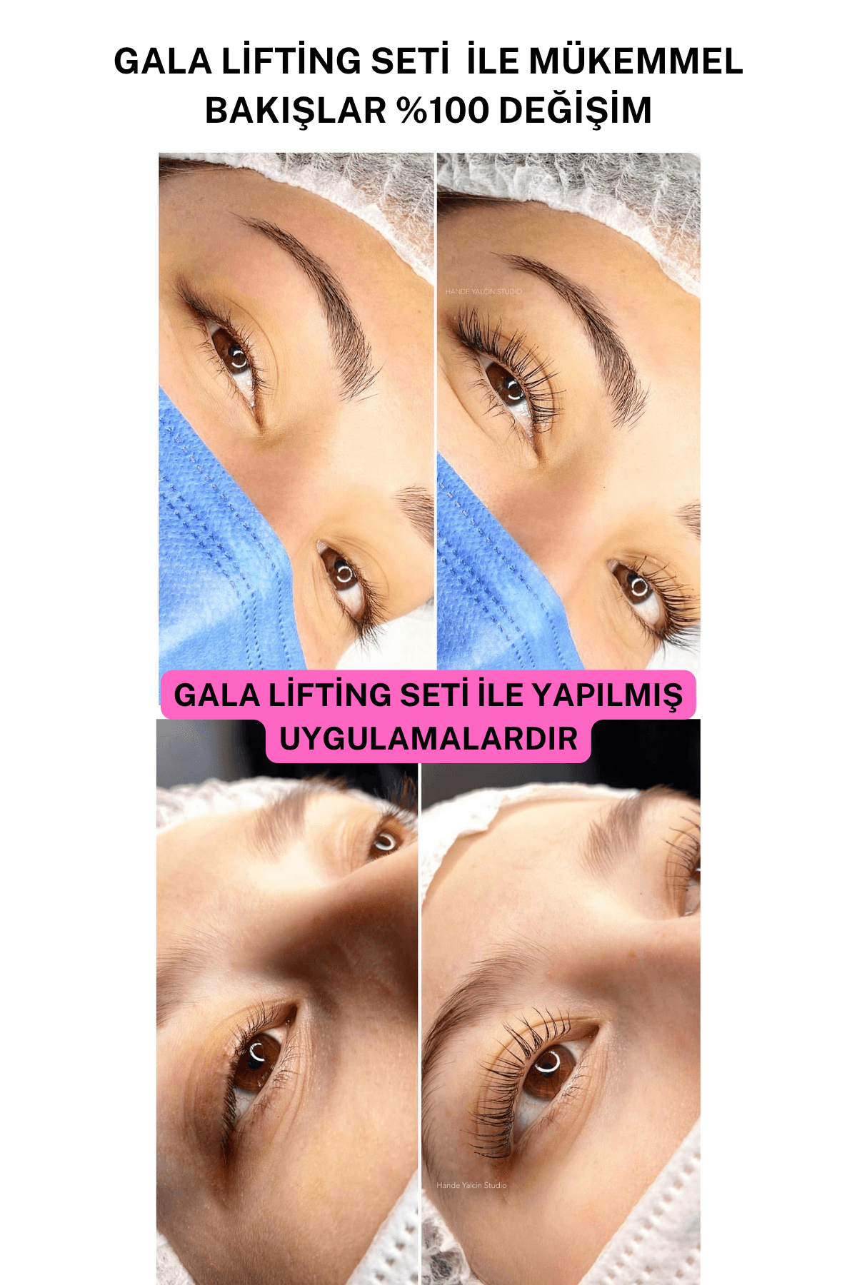 GALA LIFTING SETİ