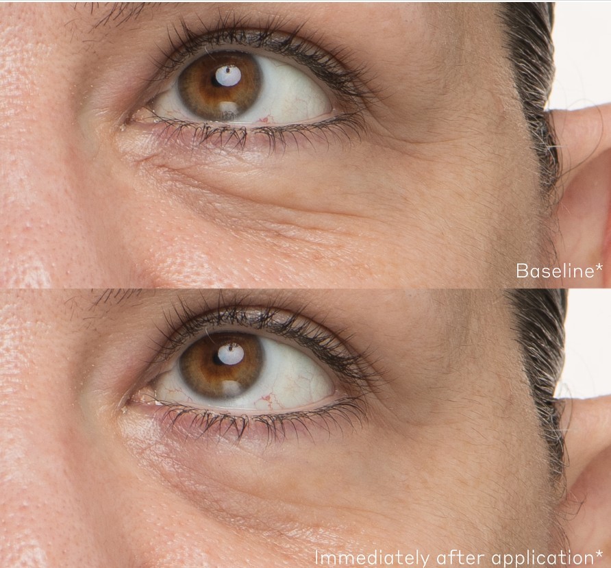 Daily Hydro-Drops® Rejuvenating Eye Gel Cream Kullanım Öncesi ve Sonrası