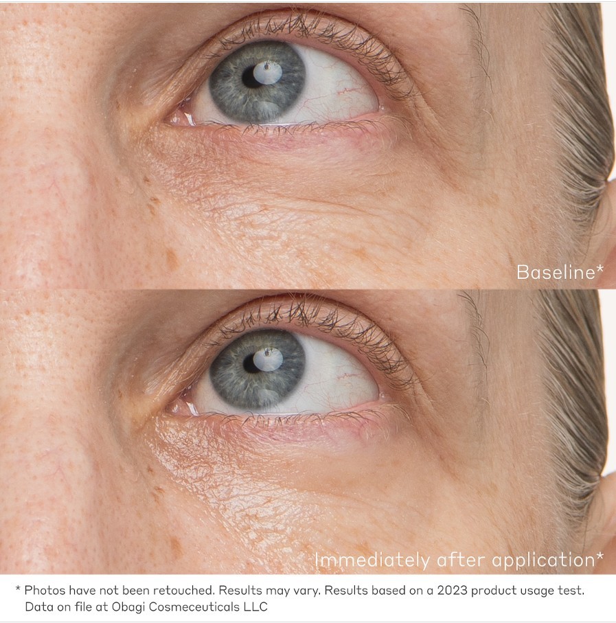 Daily Hydro-Drops® Rejuvenating Eye Gel Cream Kullanım Öncesi ve Sonrası
