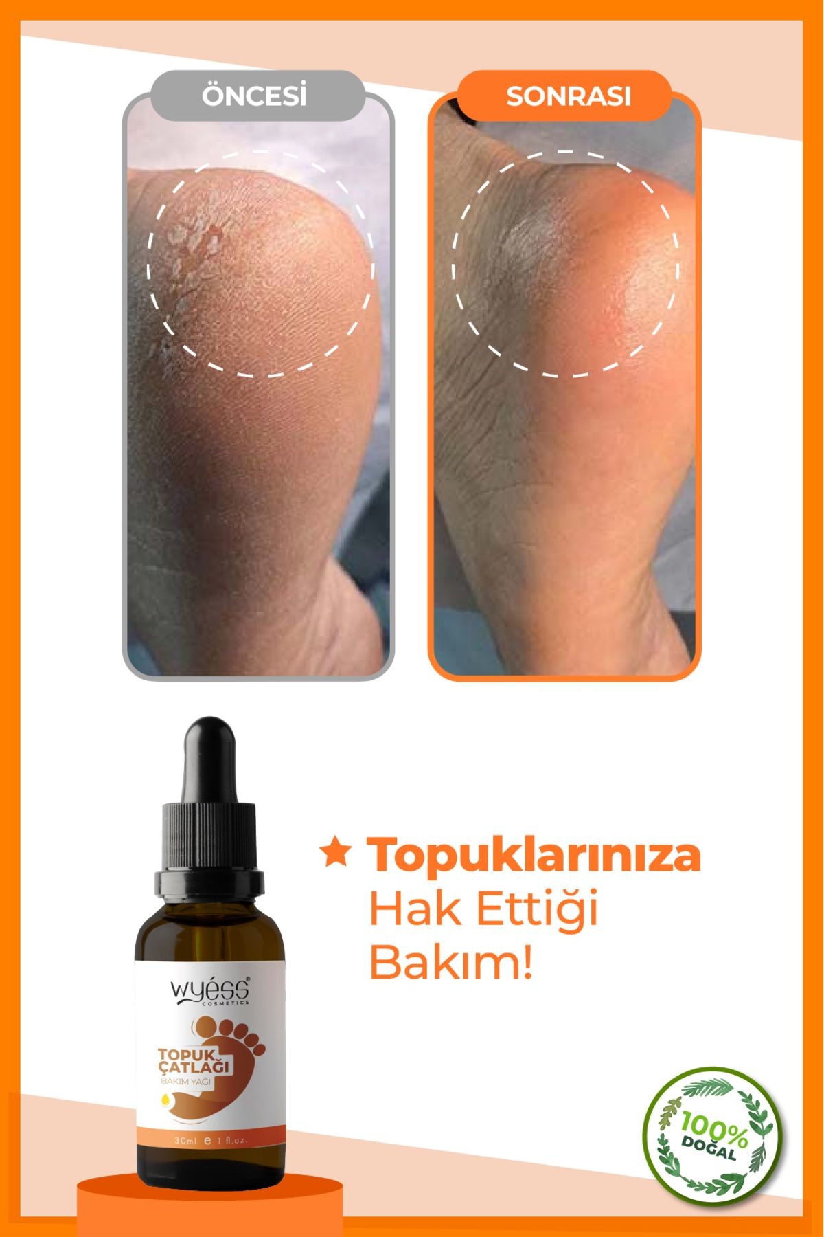 Wyess Ayak Çatlağı Bakım Yağı