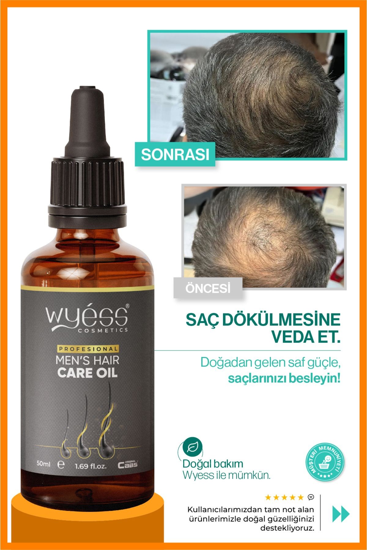 Wyess Erkek Saç Bakım Yağı