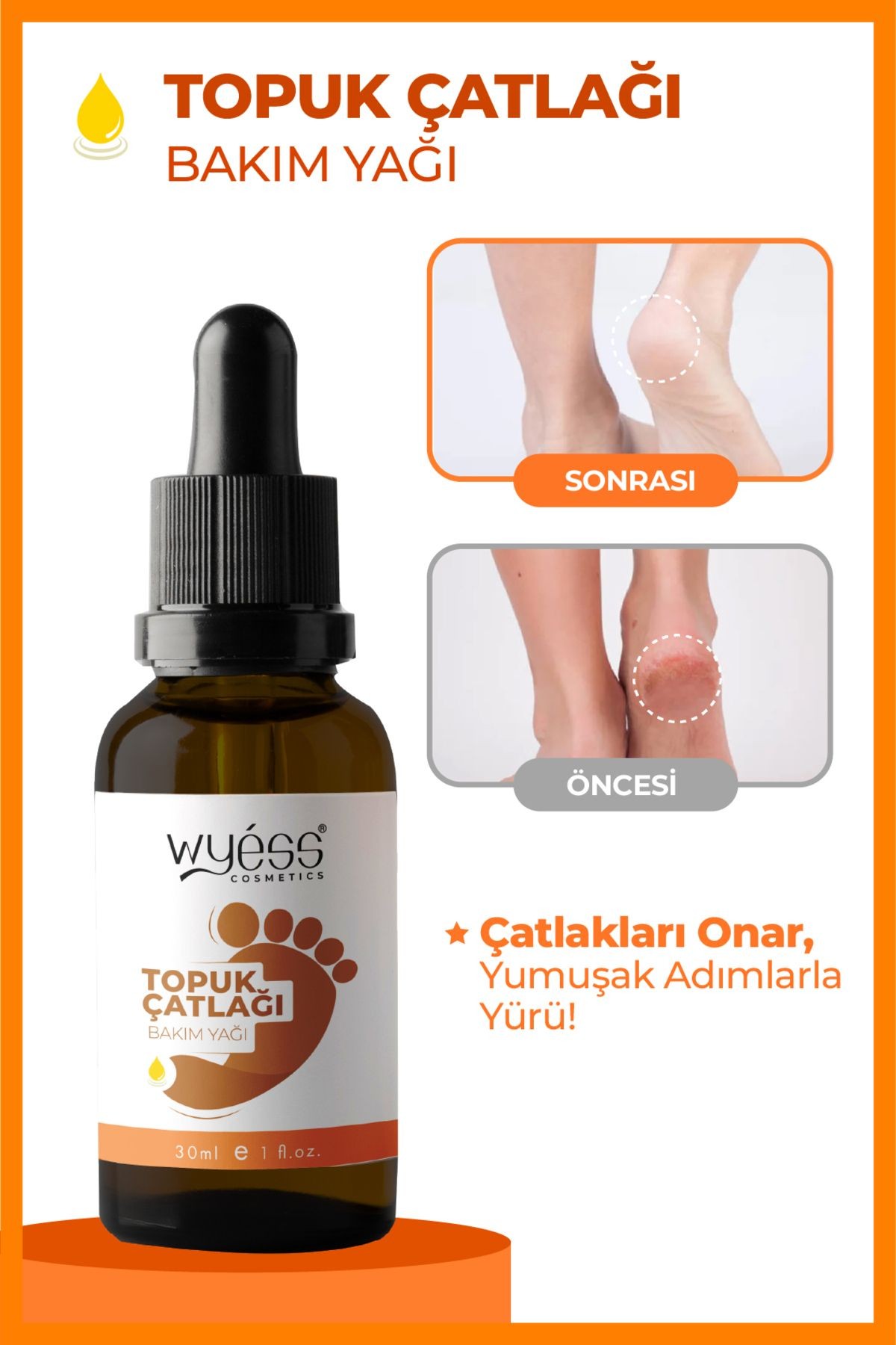 Wyess Ayak Çatlağı Bakım Yağı