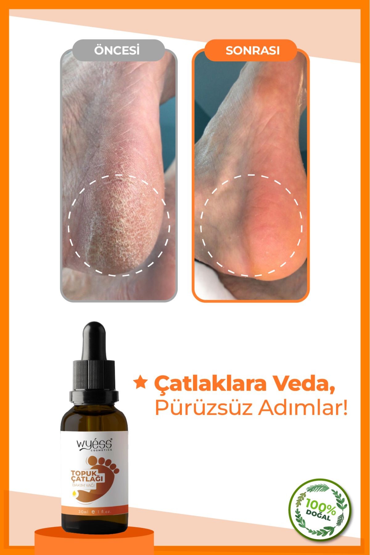 Wyess Ayak Çatlağı Bakım Yağı