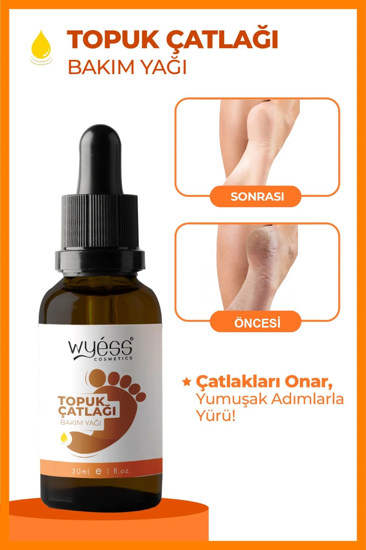 Wyess Ayak Çatlağı Bakım Yağı
