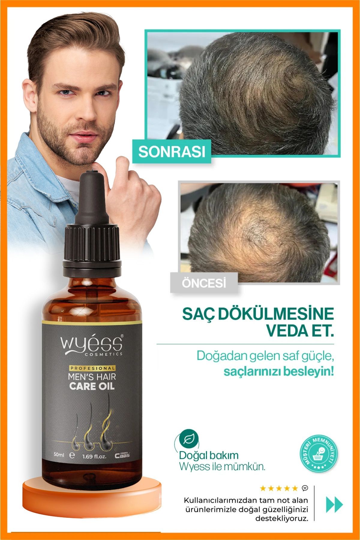 Wyess Erkek Saç Bakım Yağı