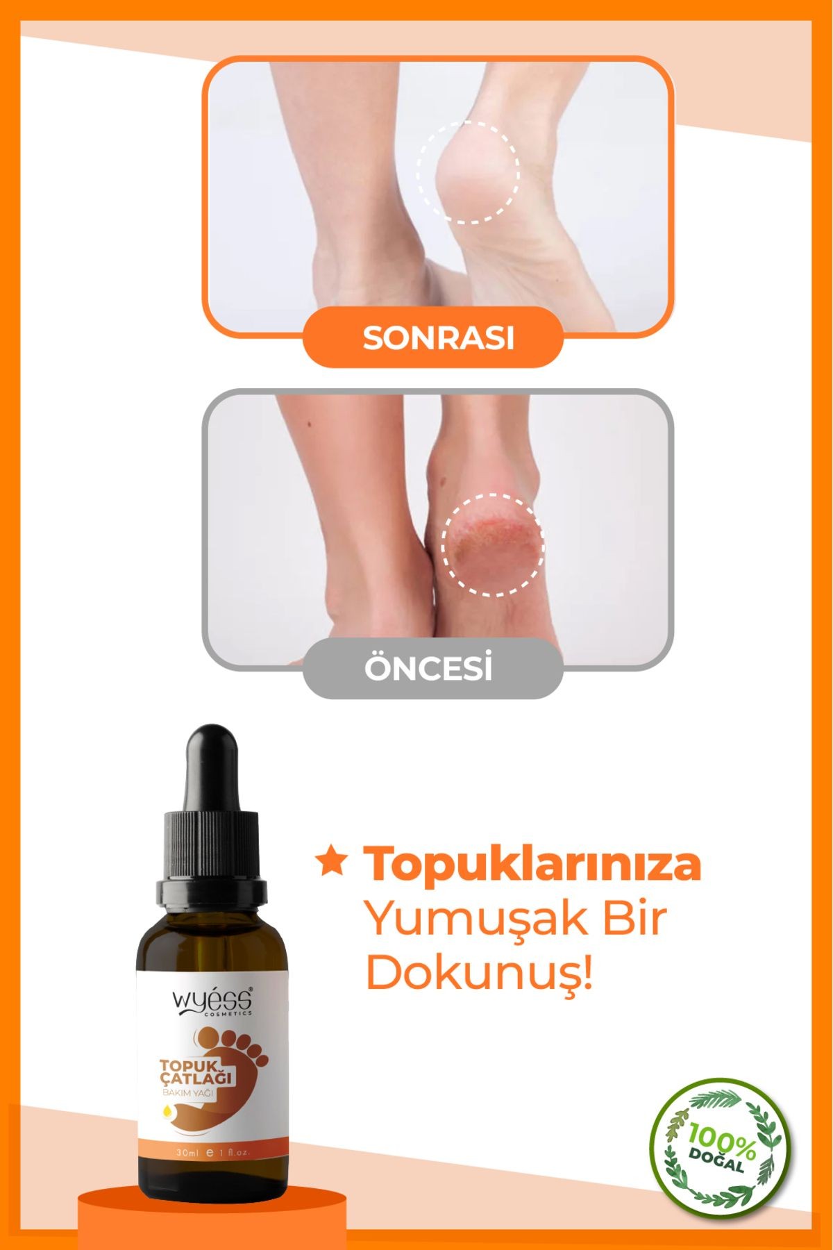 Wyess Ayak Ve Topuk Çatlağı Bakım Yağı