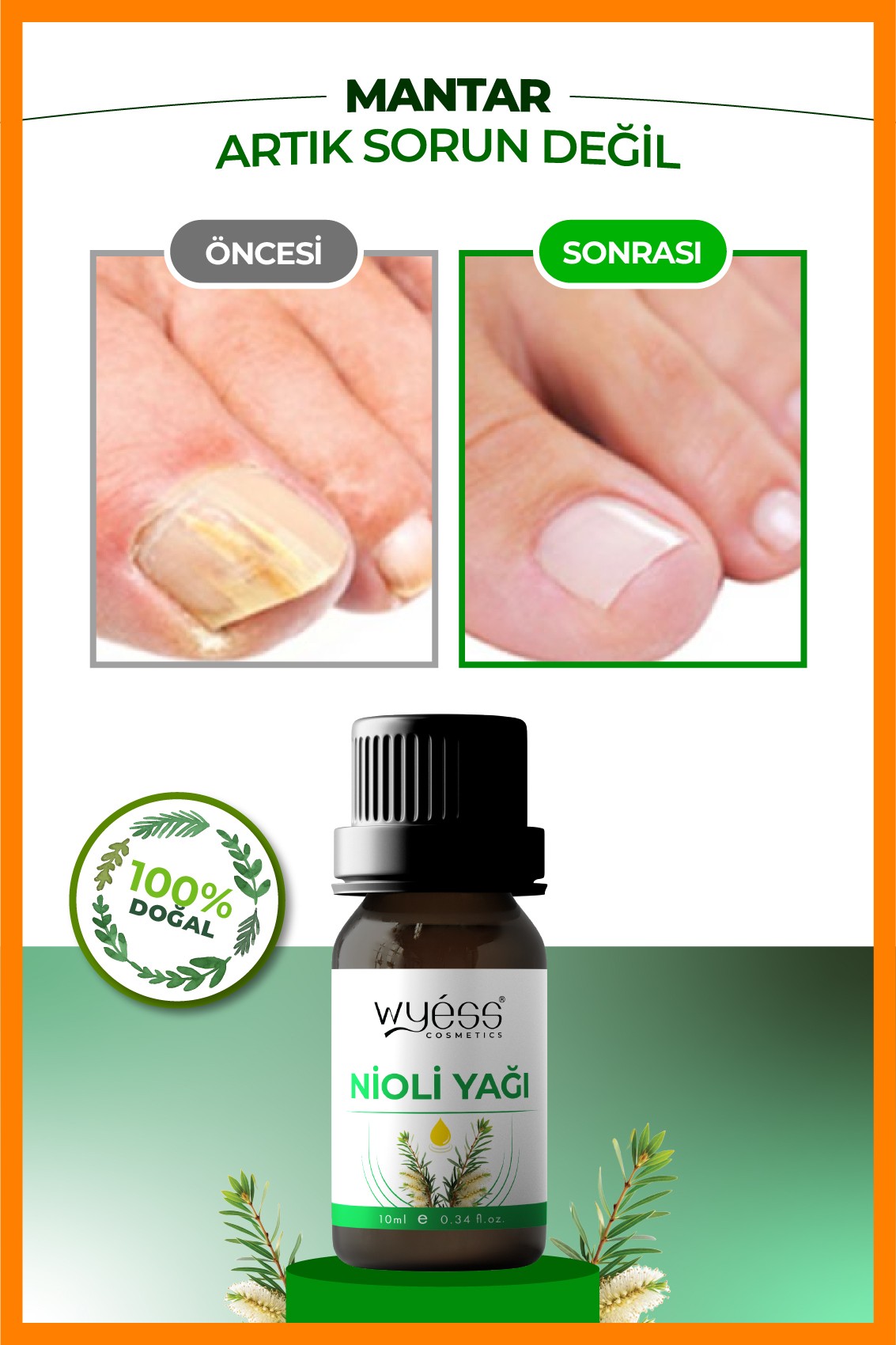 Nioli Yağı - Genital Bölge Hijyen Desteği
