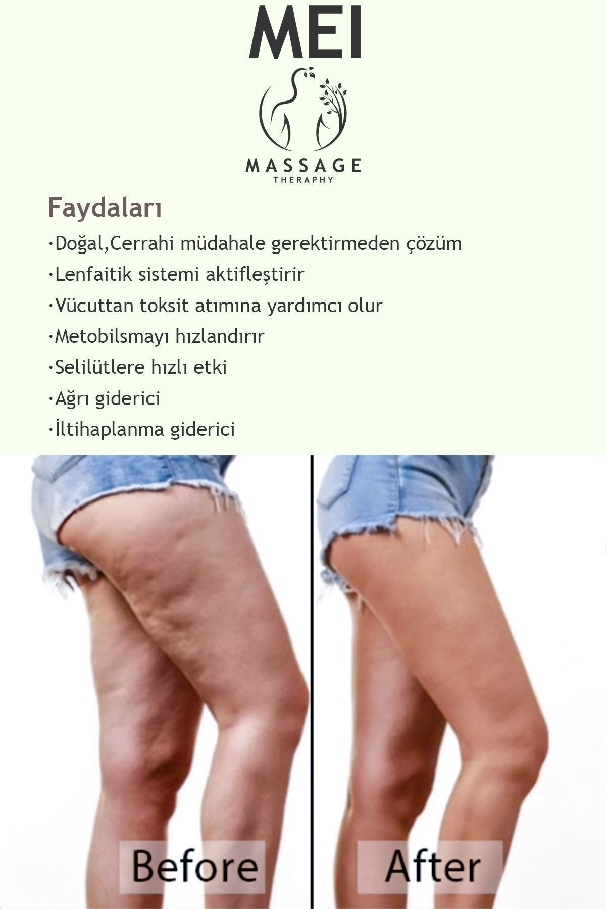 Ahşap Masaj Balık Kuyruğu Gua Sha Masajı Lenfatik Drenaj Kas Rahatlatıcı Her Noktası Özel Uygulama