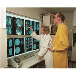 Edding Röntgen Kalemi Beyaz