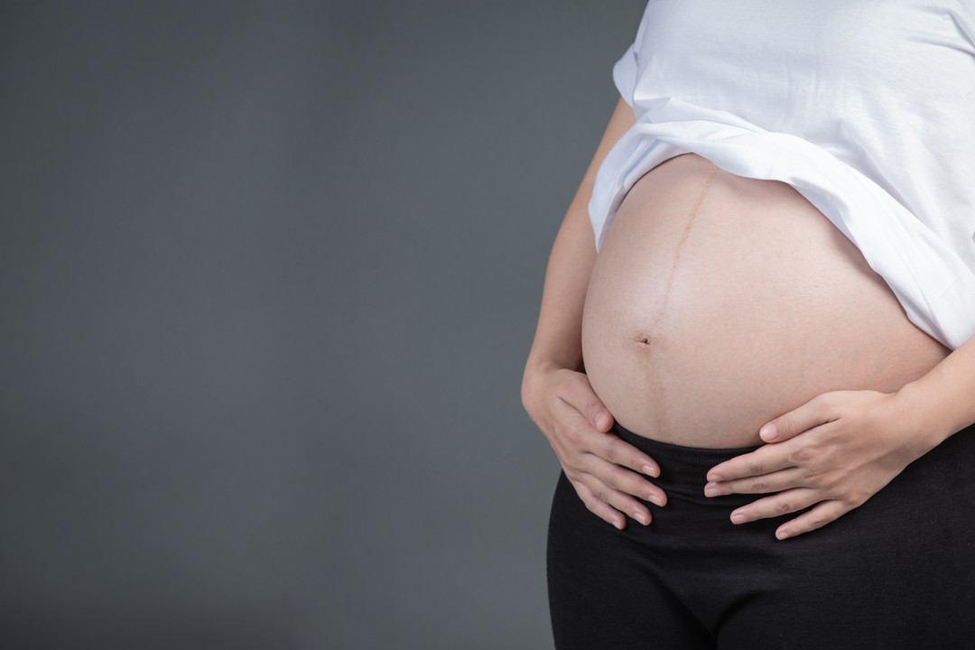 Hamilelikte cilt bakımı doğal yöntemler ve ürün önerileri 