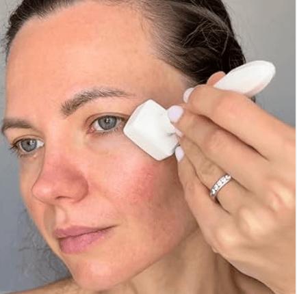 Dermastamp - Orijinal 140 Pin