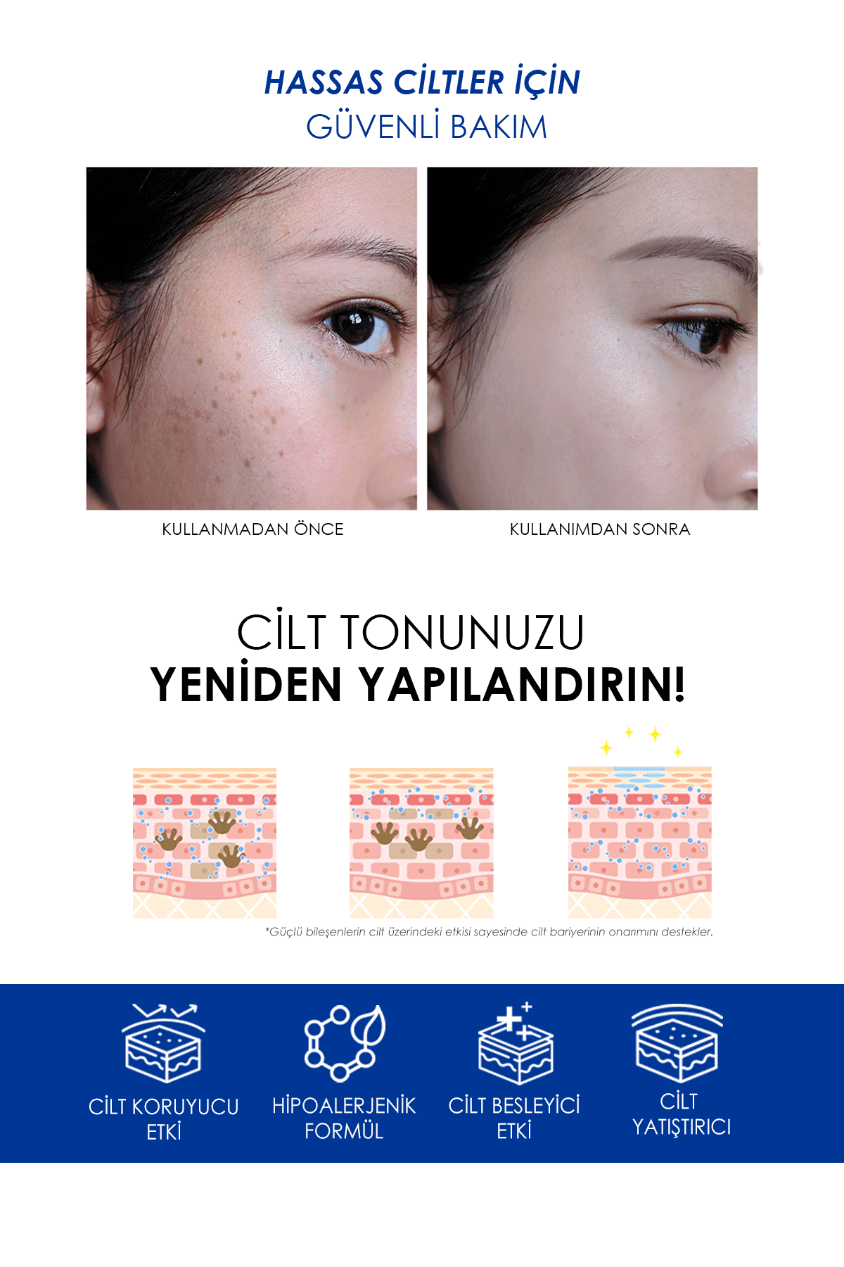 Leke Karşıtı & Cilt Tonu Eşitleyen Aydınlatıcı Hanbit Melasma Krem 50ml