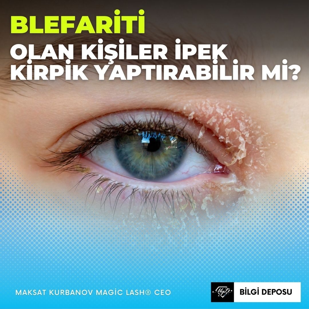 Blefariti Olan Kişiler İpek Kirpik Yaptırabilir mi?