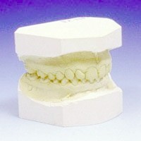 sert alçı, model alçı, dental alçı, dişçi alçısı 20 kg.