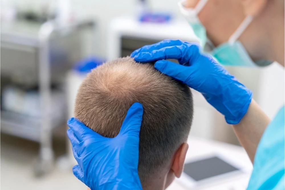 Who Can Have a Hair Transplant?