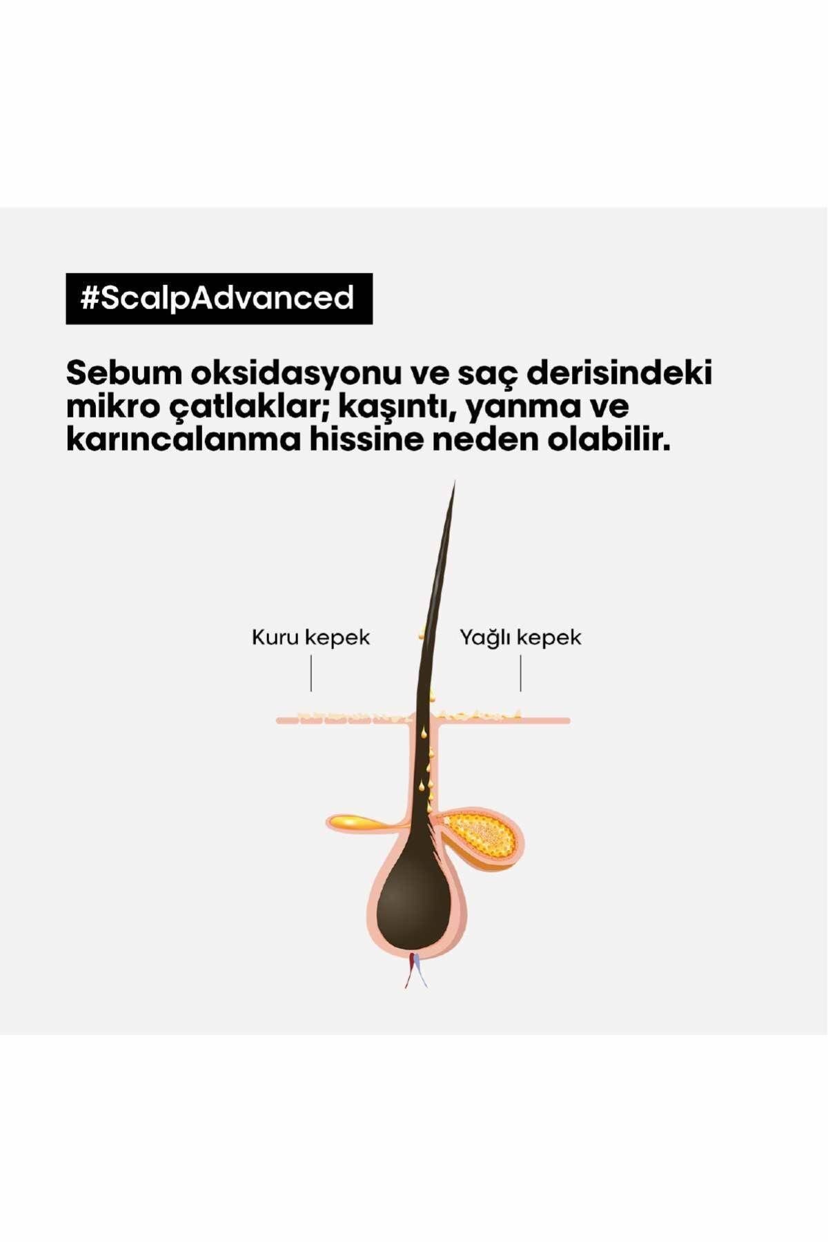 L'oreal Professionnel Scalp Advanced Kepek Karşıtı Profesyonel Şampuan 500 ml