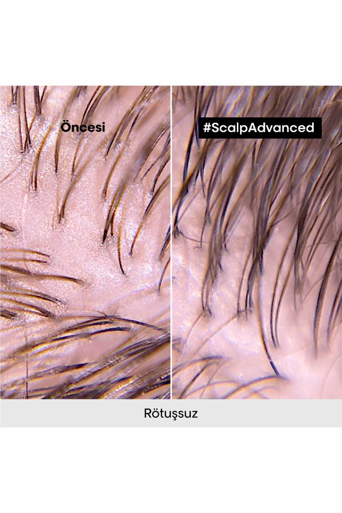 L'oreal Proffessionnel  Scalp Advanced Yağlanma Karşıtı Profesyonel Şampuan 500ml