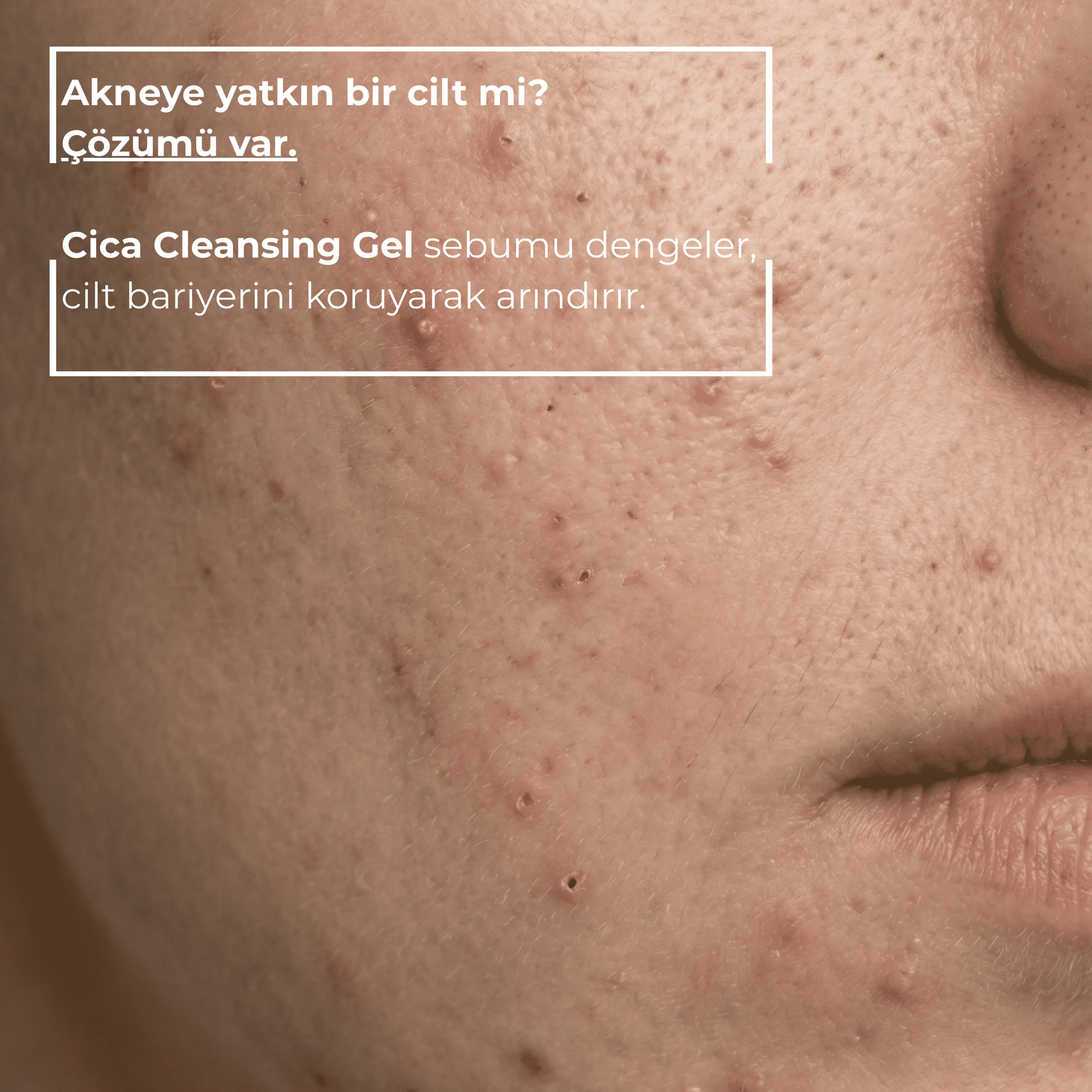 Omorfia Cica Cleansing Gel