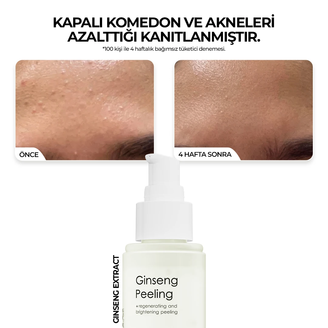 Kırmızı Kore Ginseng Özlü Anında Ölü Derilerden Arındıran, Yenileyici Aydınlatıcı Peeling 100 ml