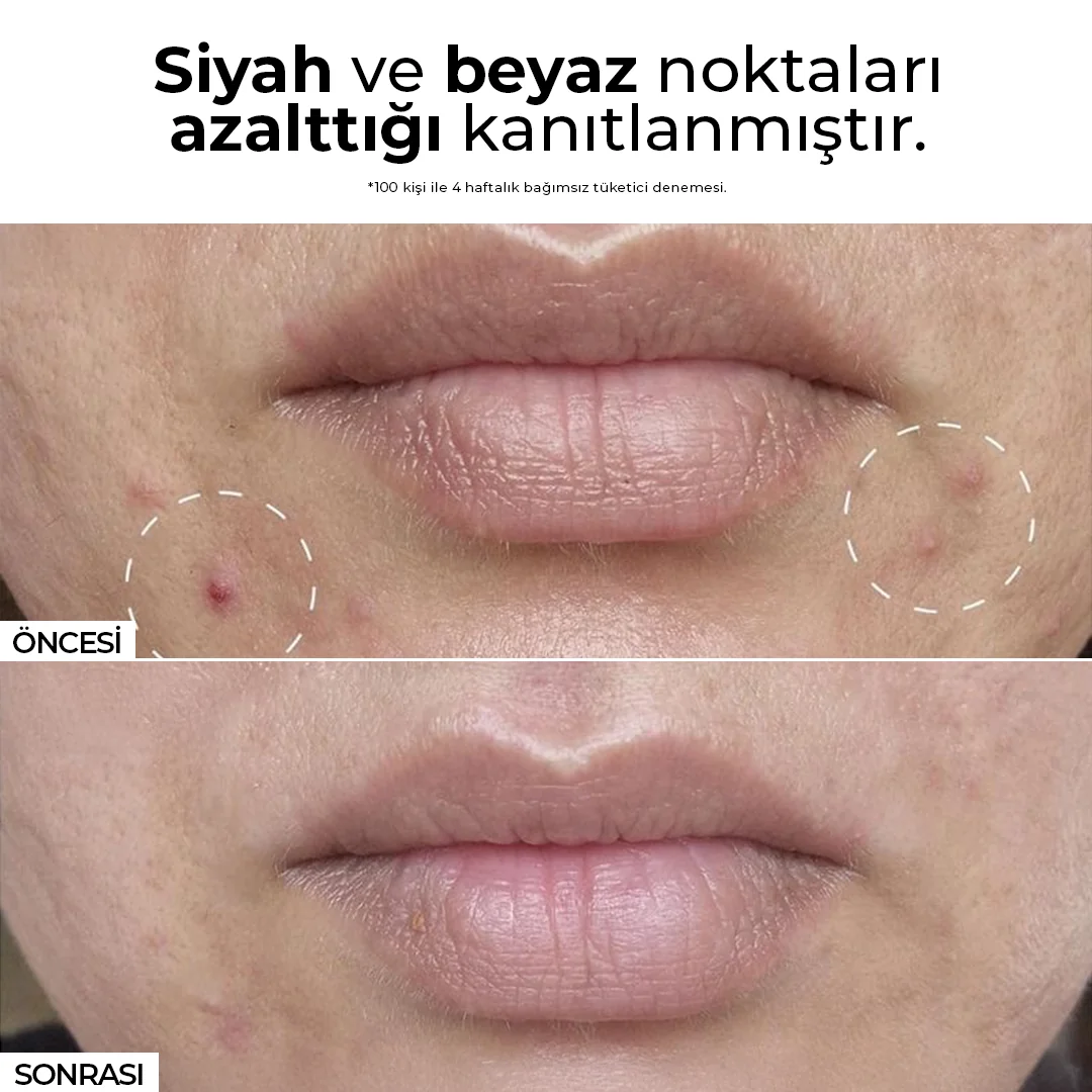 Kırmızı Kore Ginseng Özlü Anında Ölü Derilerden Arındıran, Yenileyici Aydınlatıcı Peeling 100 ml